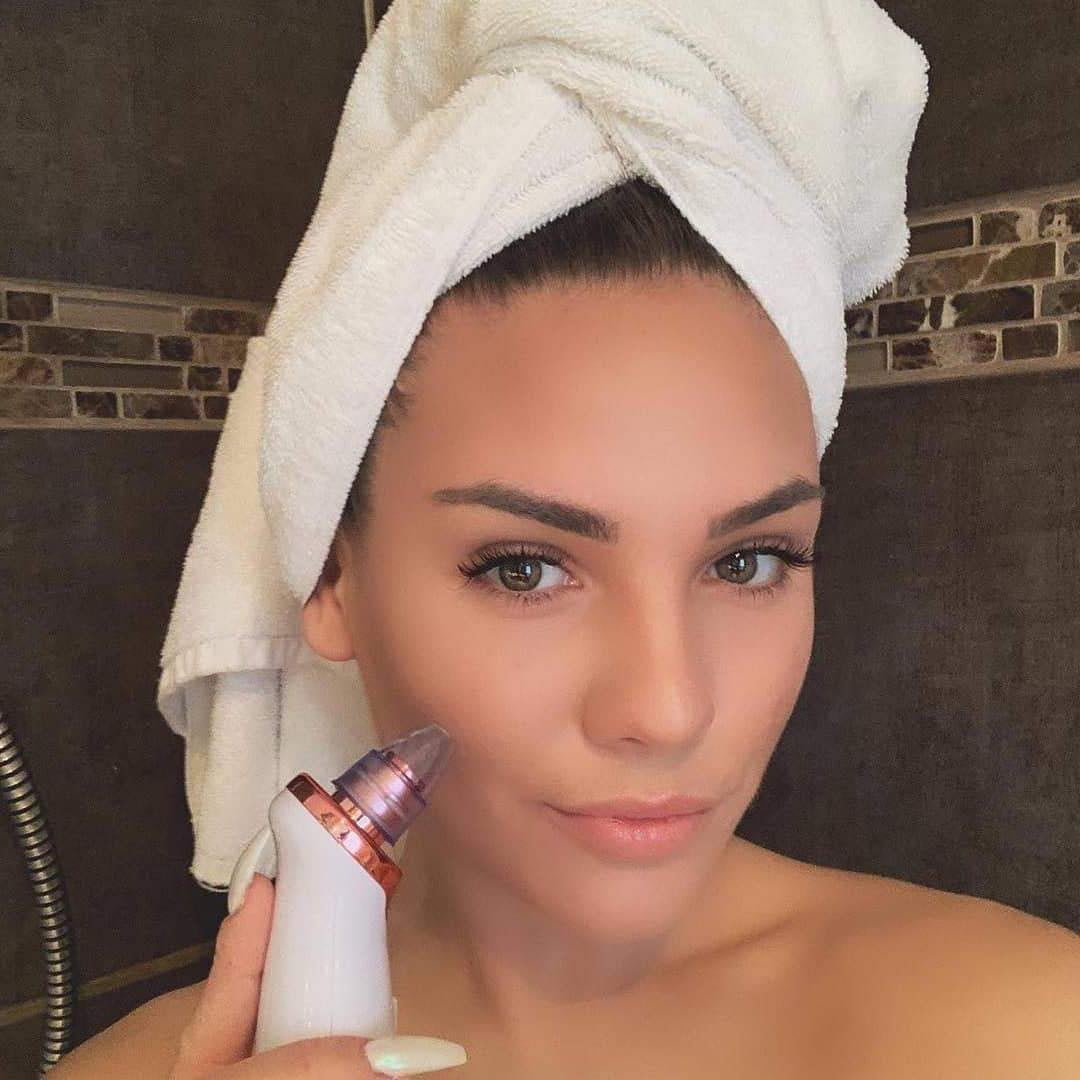 Vacuum Tool Skin Care Pore Cleaner Blackhead Pimple Acne Remover - - buy epic deals